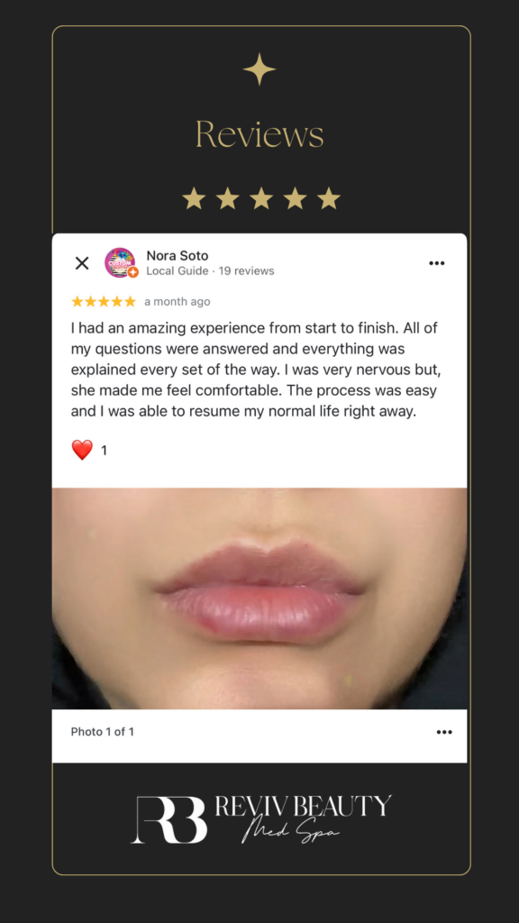 Review Nora