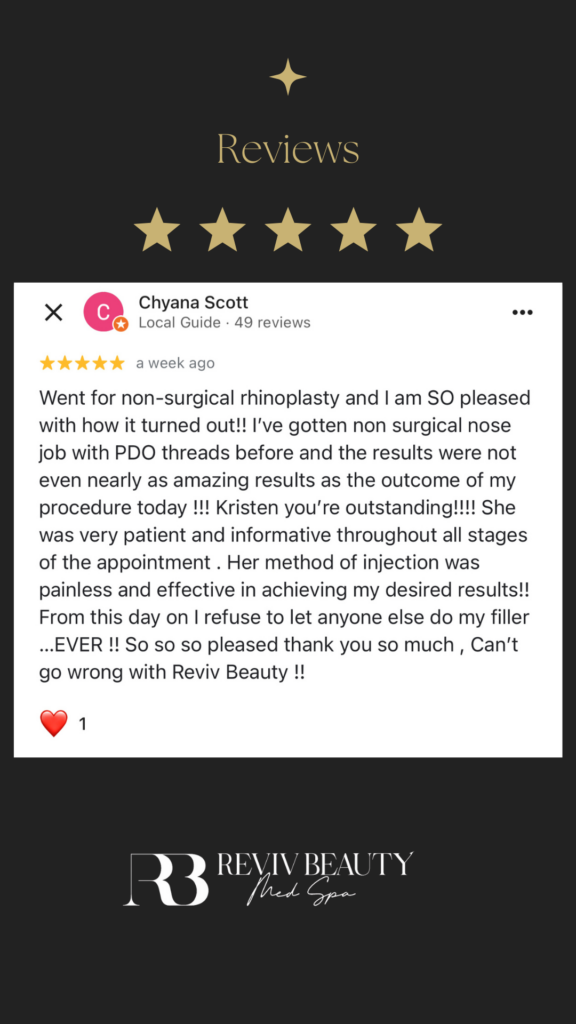 Review chyana