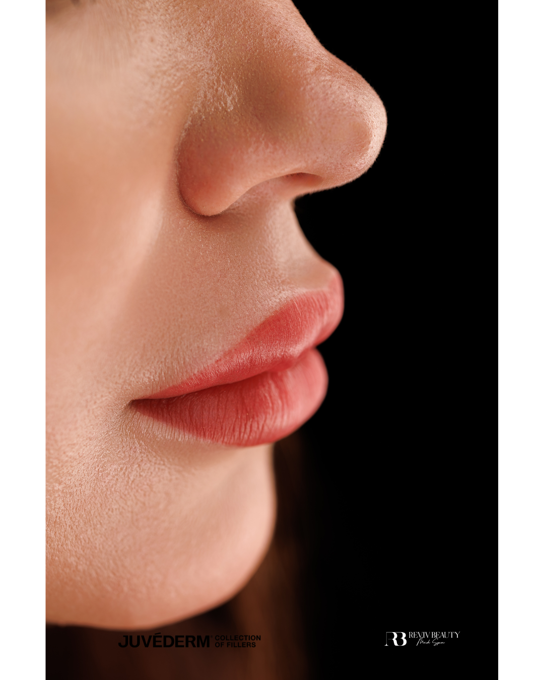 Close-up of Juvederm lip filler results at Reviv Beauty Med Spa in Sanford FL, showing smooth, hydrated, and naturally enhanced lips.